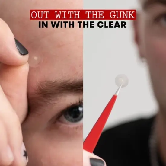 Thayers Natural Remedies Invisible S.O.S Hydrocolloid Ultra-Thin Acne Pimple Patch - 22ct image {2}