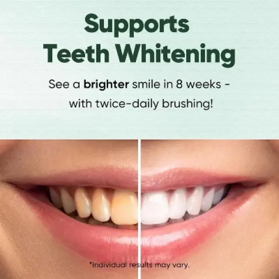 MySmile Nano-Hydroxyapatite Toothpaste image {4}