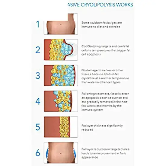 Fat Freezer image {6}