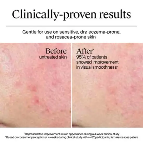 Neutrogena Hydro Boost Water Face Cream with Hyaluronic Acid - Fragrance Free image {12}