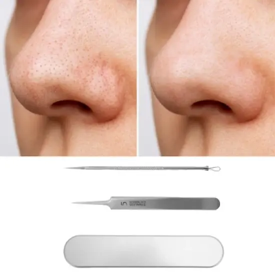 Unique Bargains Convenient Pimple Extractor 5.51"x1.15" Silver Tone 1 Set image {4}