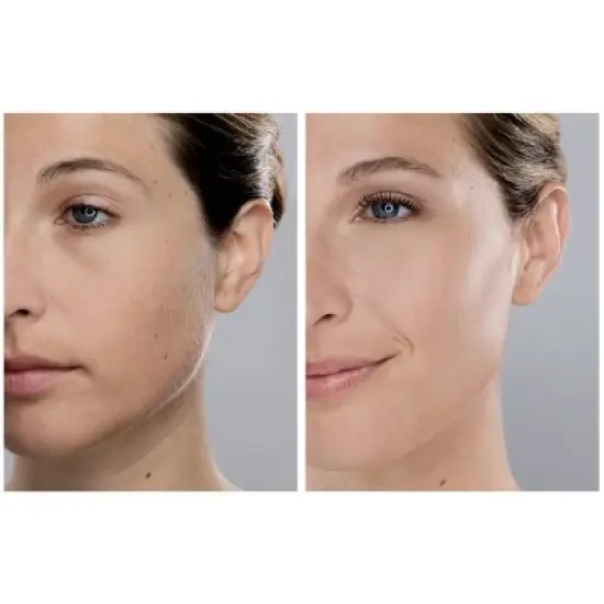 Spa Sciences SIMA Dermaplaning Replacement Safety Tips - 6ct image {5}