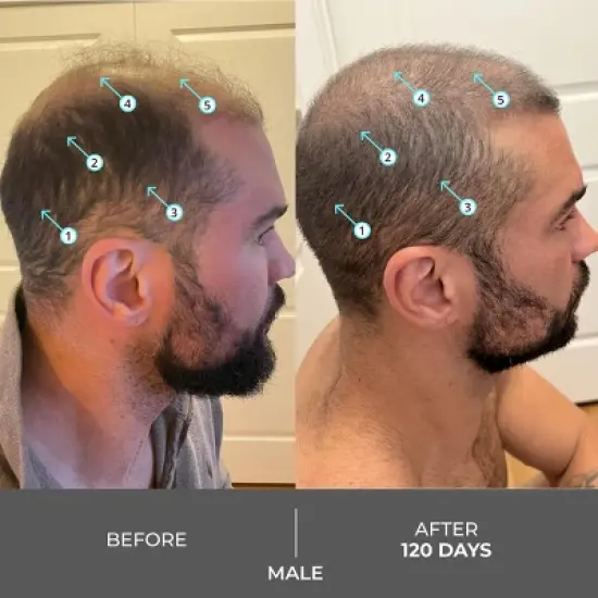 Revita | Extra Strength Hair DENSITY Shampoo image {10}