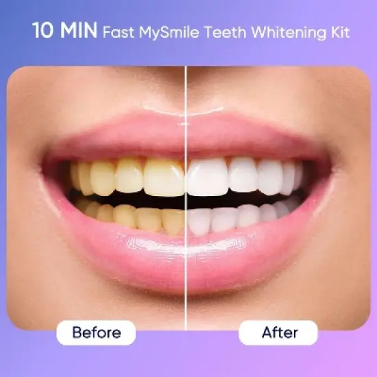 MySmile Premium 10 Min Teeth Whitening Kit with 28 LED Light, 35% CP Teeth Whitening Gel image {1}