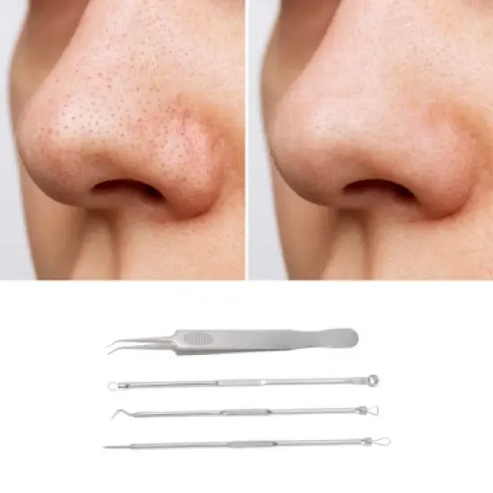 Unique Bargains Thread Pimple Extractor Kit Silver Tone 1 Set image {4}