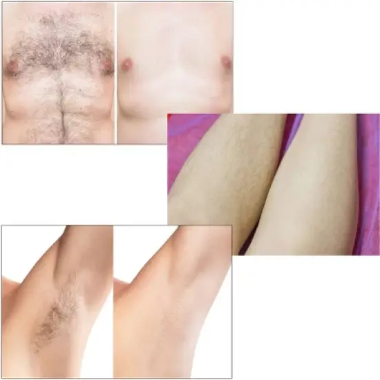 Spa Sciences LEXI IPL Permanent Hair Removal System for Face & Body, FDA Cleared image {3}