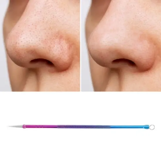 Unique Bargains Convenient Nano Pimple Extractor Blue Purple 1 Pc image {4}