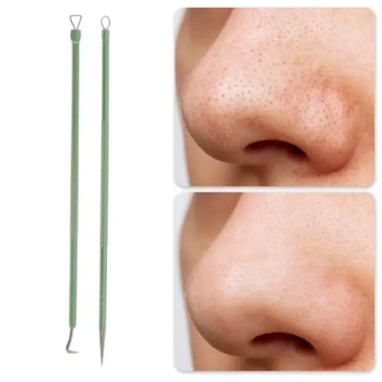 Unique Bargains Durable Straight Clip Pimple Extractor Tool Kit Green 1 Set image {4}