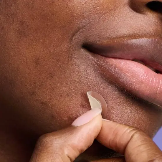 Hero Cosmetics Mighty Acne Patch Micropoint for Dark Spots - 8 patches image {8}