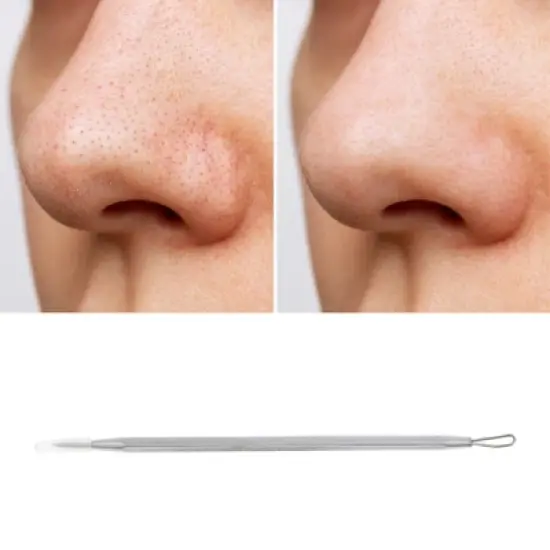 Unique Bargains Convenient Acnes Pimple Extractor Silver Tone 1 Pc image {4}