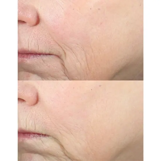 derma e Skin Restore Mask - 2 fl oz image {4}