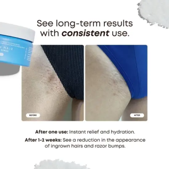 Bushbalm Nude Ingrown Hair Exfoliating Scrub - 8 fl oz image {2}