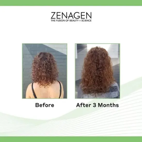 Zenagen Evolve Nourishing Shampoo (16 oz) and Evolve Nourishing Conditioner (16 oz) - XXL Hair DUO SET Kit image {1}