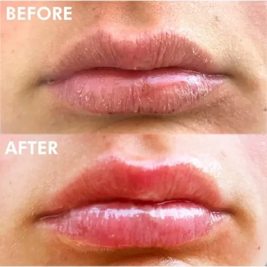 Lanolips Ultra Healing 101 Ointment Multi-Use Lip Balm - Strawberry - 0.35oz image {2}