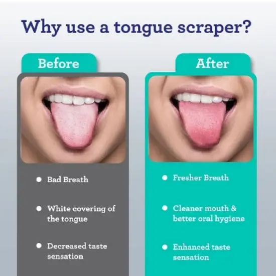 GuruNanda Spoon Shaped Stainless Steel Tongue Scrapers - 2ct image {3}