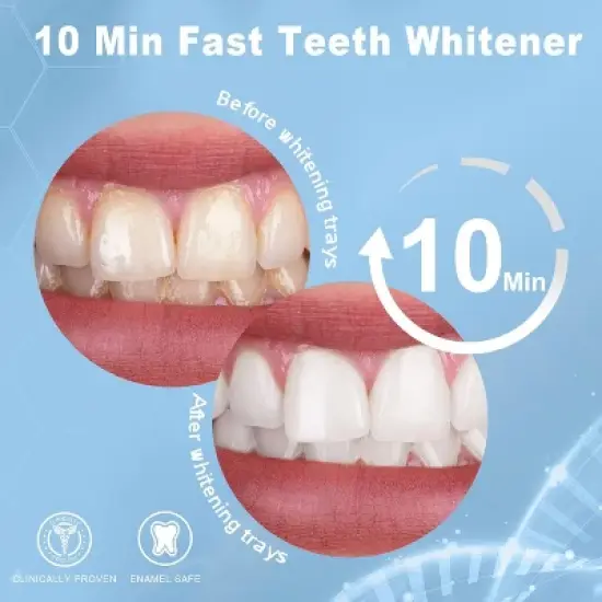MySmile Teeth Whitening Kit with LED Light, 10 Min, 3 * 22% CP Teeth Whitening Gel image {1}
