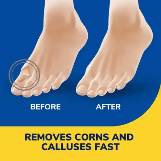 Dr. Scholl's Liquid Corn and Callus Remover - 0.33oz image {3}