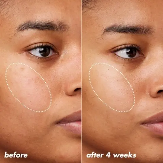 e.l.f. SKIN Holy Hydration! Thirst Burst Moisturizer Drops - 1 fl oz image {5}