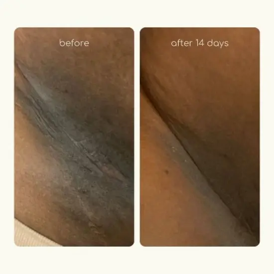 Forgotten Skincare The Original Underarm Brightening Deodorant Cream - 1.7 fl oz image {3}