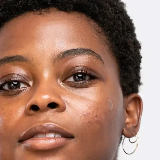 Hero Cosmetics Mighty Patch Invisible Acne Pimple Patches - 39ct image {5}