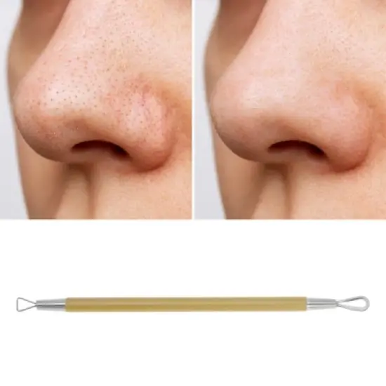 Unique Bargains Portable Double Headed Pimple Extractor 1 Pc image {4}
