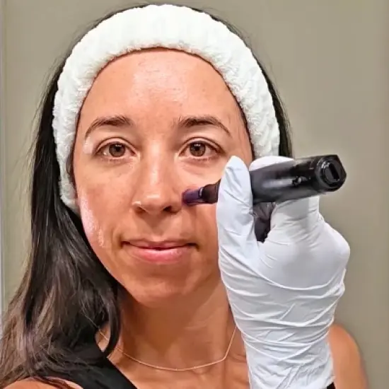 Beautimate Microneedle Pen &ndash; Adjustable At-Home Microneedling Device for Fine Lines, Wrinkles, and Firmer Skin image {10}