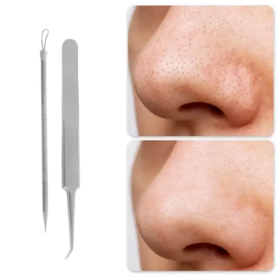 Unique Bargains Purification Pimple Extractor Tool Kit Silver Tone 1 Set image {4}