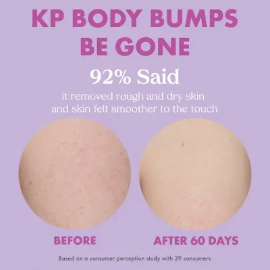 Kopari Women's KP Body Bumps Be Gone - 8.45oz - Ulta Beauty image {6}
