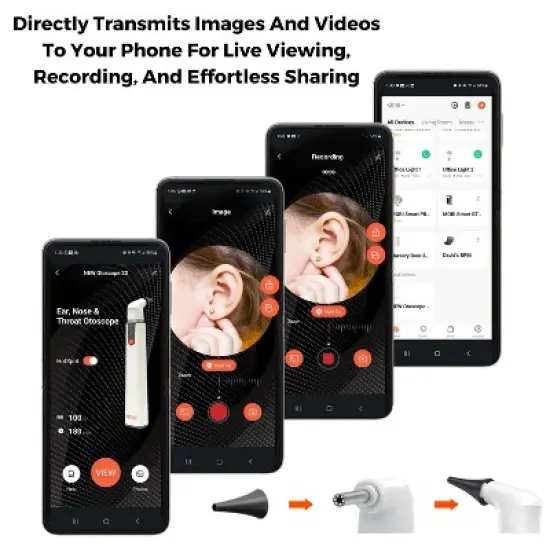 MOBI Wi-Fi Otoscope for Baby 1080P HD Camera, 6 LED, Ear Nose Throat Scope + Cleaning Tools image {2}