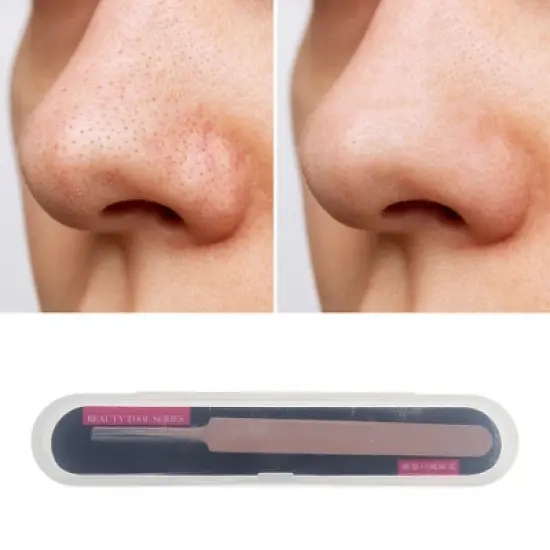 Unique Bargains Portable Straight Pimple Extractor Pink 1 Pc image {4}