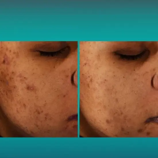 L'Oreal Paris Bright Reveal 12% Niacinamide Dark Spot Serum - 1 floz image {4}