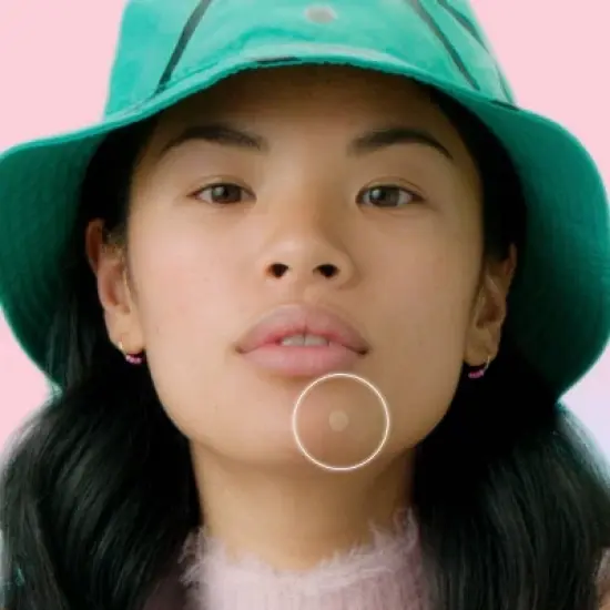 ZitSticka Goo Getter Surface Pimple Hydrocolloid Patch - 36ct image {3}