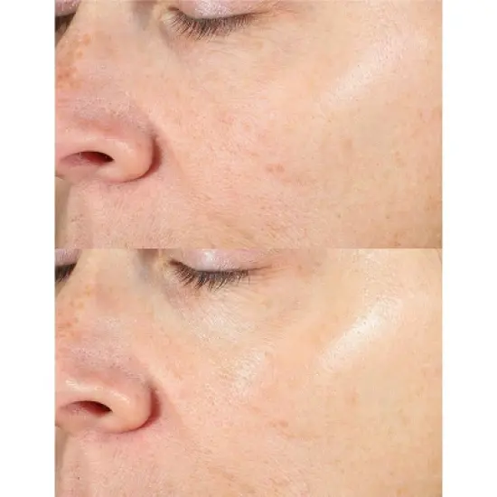 derma e Vitamin C Serum - 2 fl oz image {5}