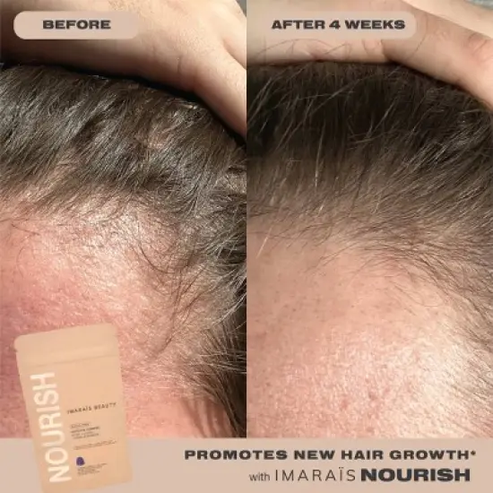 Imarais Beauty Nourish Haircare Gummies for Hair Growth, Anti-Shedding - Vegan and Sugar-Free - 30ct image {5}