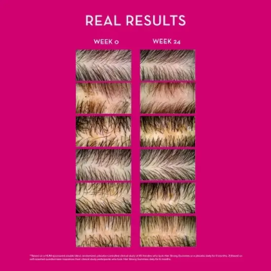 HUM Nutrition Hair Strong Vegan Capsules for Hair Growth + Strength + Thickness - 30ct image {3}