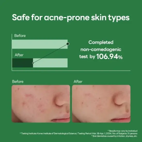 Mediheal Teatree Calming Hydra Serum - 1.35 oz image {4}