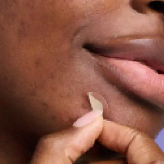 Hero Cosmetics Mighty Acne Patch Micropoint for Dark Spots - 8 patches image {6}