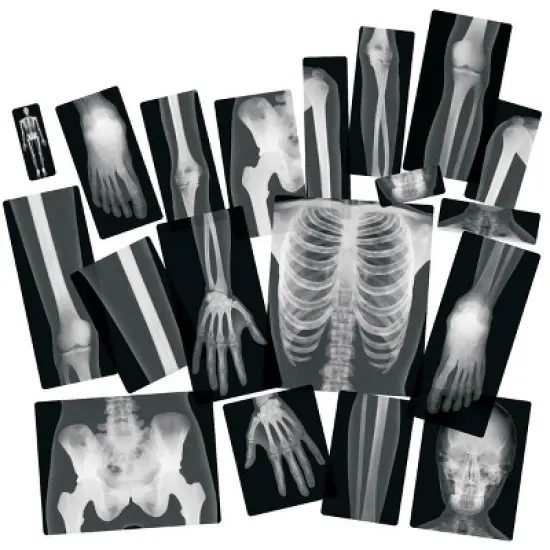 Royclo Human X-Rays on Film - 18 Pieces image {1}