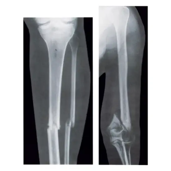 Roylco Broken Bones X-Rays image {3}