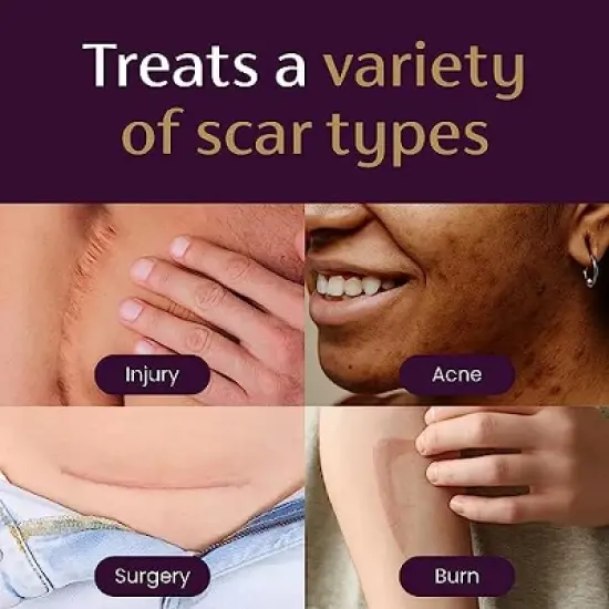 Mederma Advanced Scar Gel 1.76 Oz image {2}