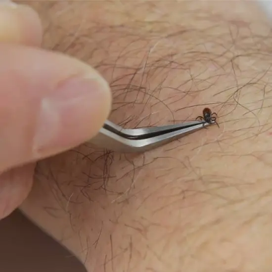 Bug Bite Thing Tick Remover Tool image {2}