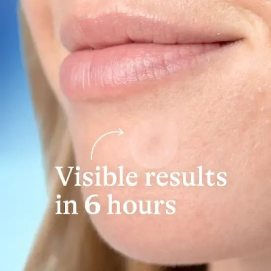 Differin Acne Pimple Patches - 36ct image {2}