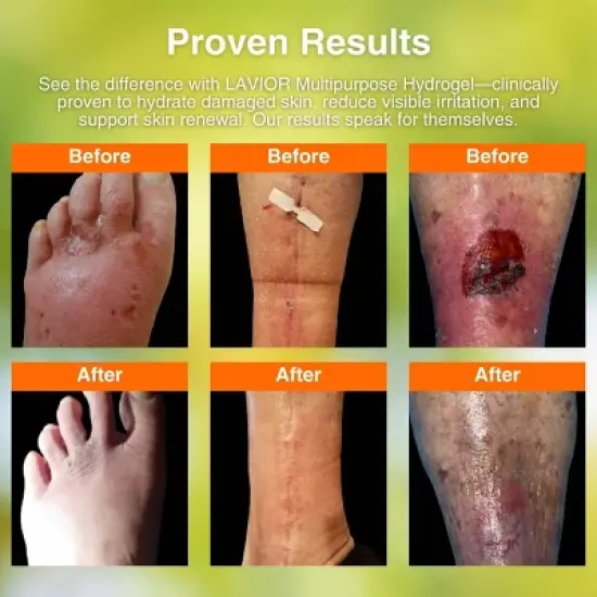 Lavior Multipurpose Hydrogel for Cuts, Scrapes, Burns & Wounds - 1 fl oz image {5}
