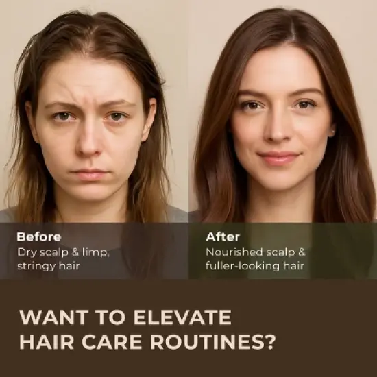 Rosemary Essential Oil (4 Fl Oz / 118 ml) -Gya LabsRosemary Oil for Hair, Scalp image {1}