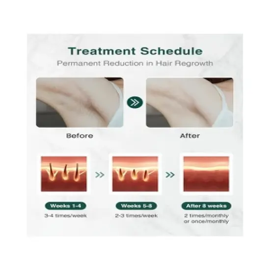 JOVS X Hair Removal and Skin Care Device with Completely Painless IPL Hair Removal, Skin Rejuvenation, and Ionpenetration image {2}