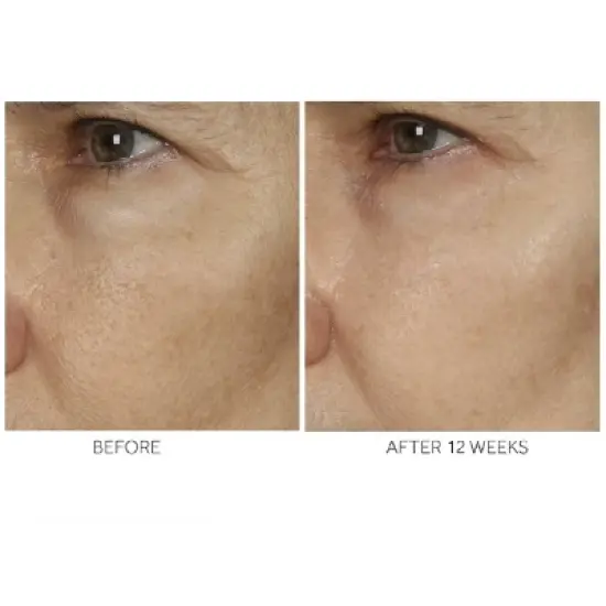 No7 Advanced Retinol 1.5% Complex Night Concentrate - 1 fl oz image {3}