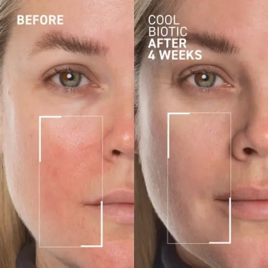 Dr. Brandt Cool Biotic - Prebiotic Redness Cream image {1}