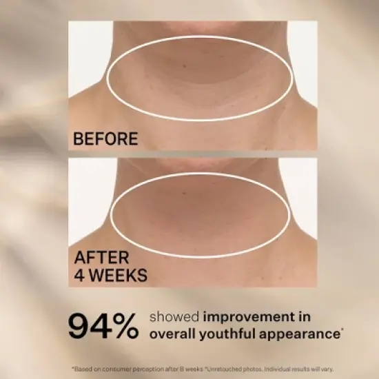 StriVectin Tightening Neck Cream - 1oz - Ulta Beauty image {6}