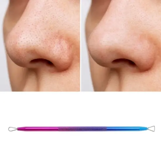 Unique Bargains Professional Nano Pimple Extractor Blue Purple 1 Pc image {4}