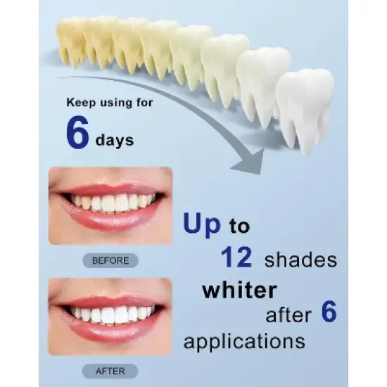 MySmile Teeth Whitening Strips with 28 LED Light, 10 Min Fast Whitening, 14 Treatments image {7}
